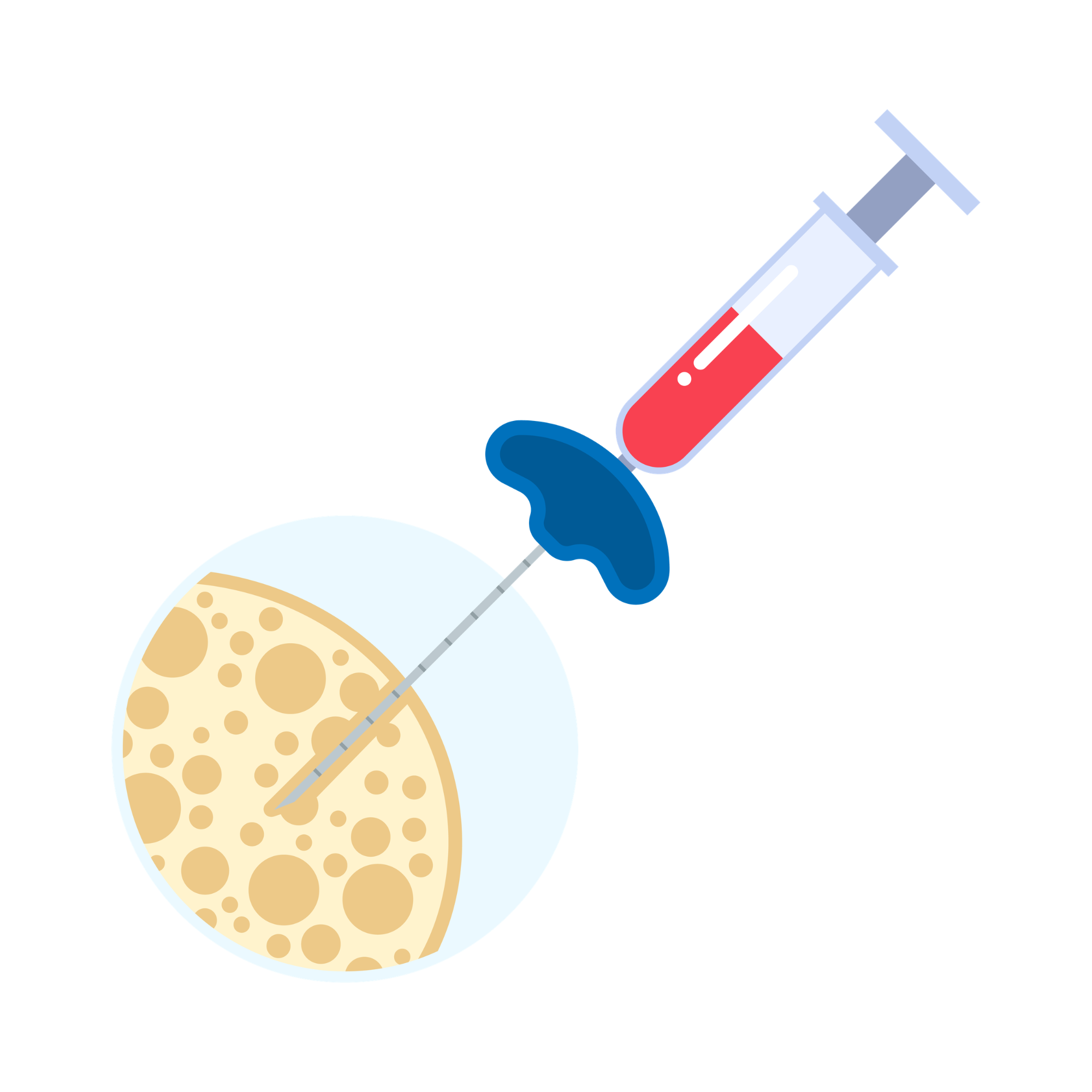 IMEB biopsie